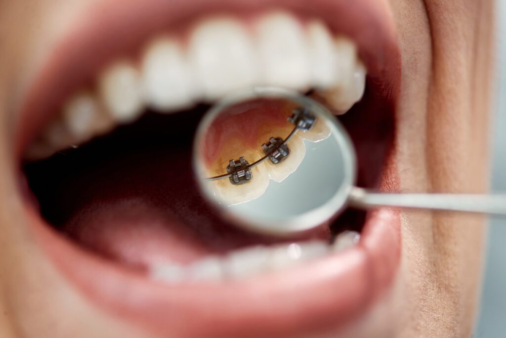 Springfield Family Dental -